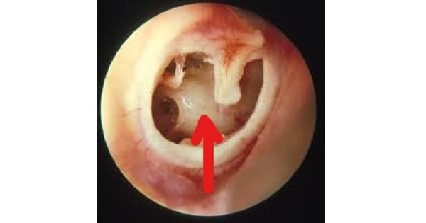 Image Based Question