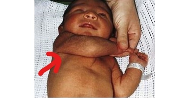 Image Based Question