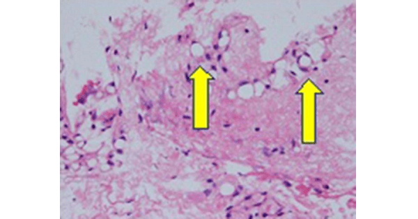 Image Based Question