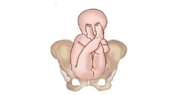 Image Based Question
