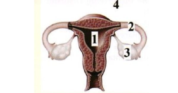 Image Based Question