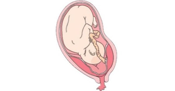 Image Based Question