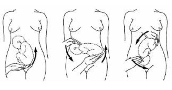 Image Based Question