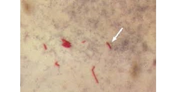 Image Based Question