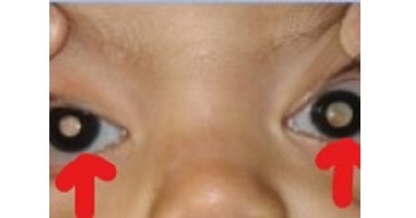 Image Based Question