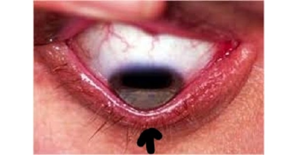 Image Based Question