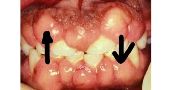 Image Based Question