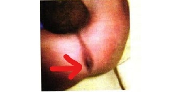 Image Based Question