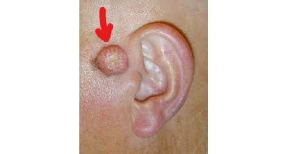 Image Based Question