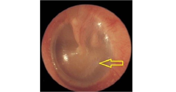 Image Based Question