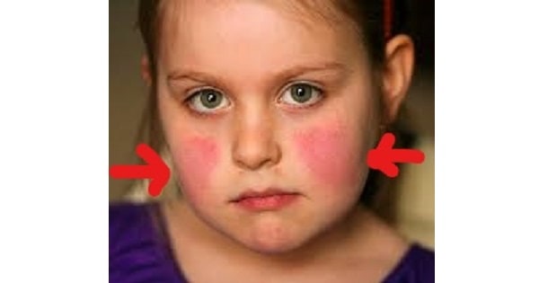Image Based Question