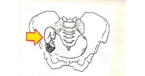 Image Based Question