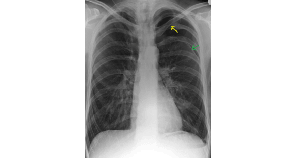 Image Based Question