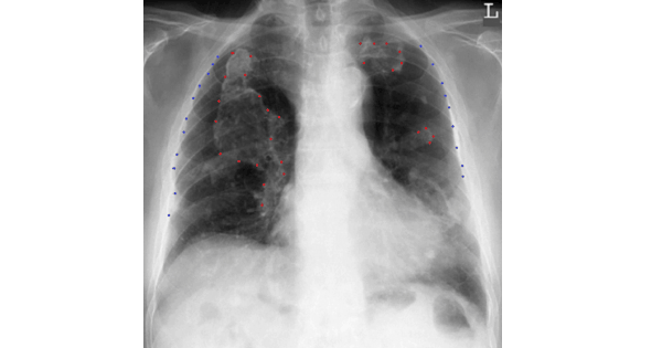 Image Based Question