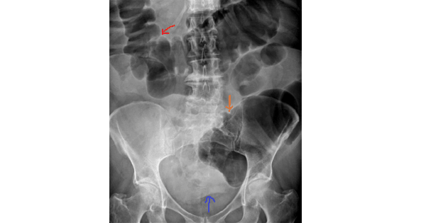Image Based Question