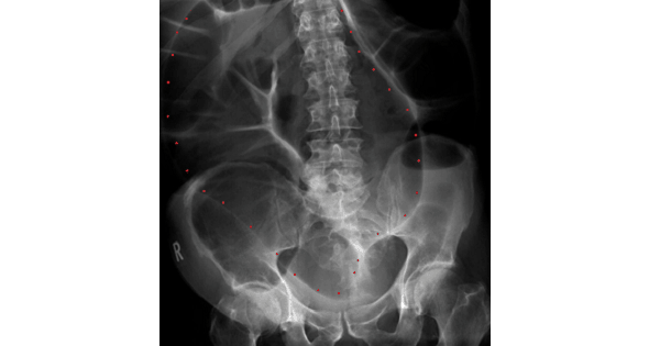 Image Based Question