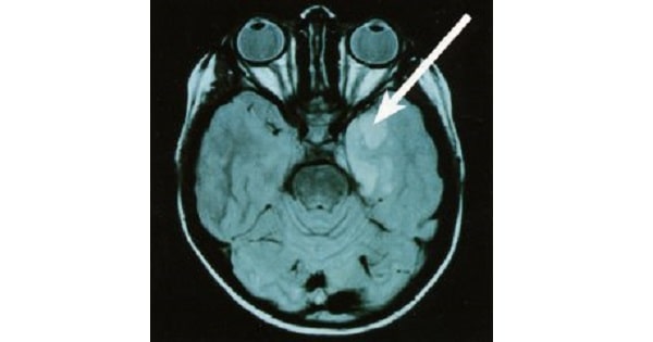 Image Based Question