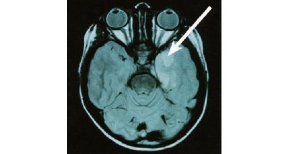 Image Based Question