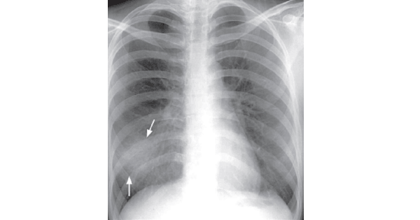 Image Based Question