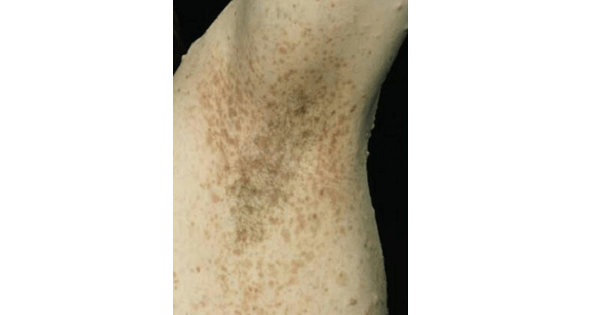 Image Based Question