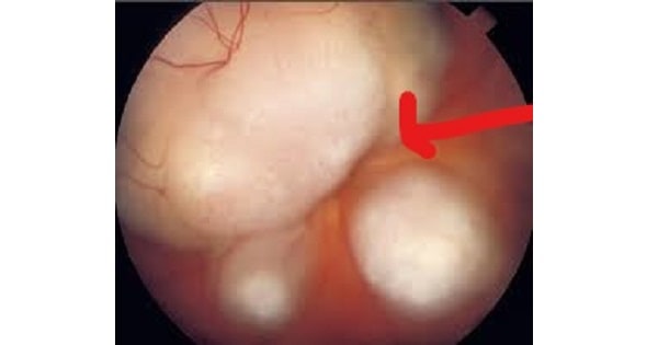 Image Based Question