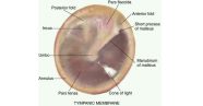 Malleus Tympanic Membrane