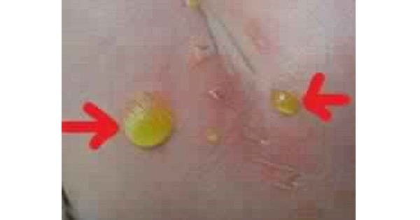 Image Based Question