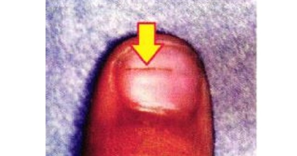 Image Based Question