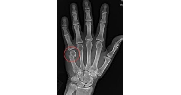 Image Based Question