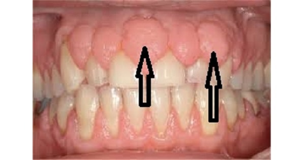 Image Based Question