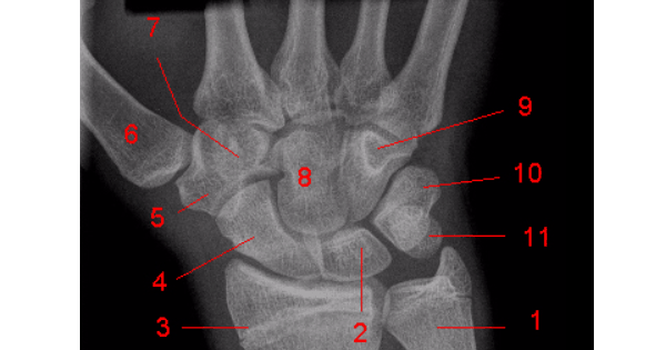 Image Based Question