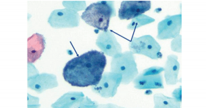 Papanicolaou Test - New