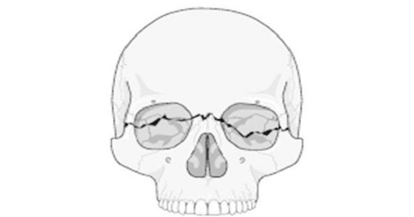 Image Based Question
