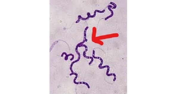 Image Based Question