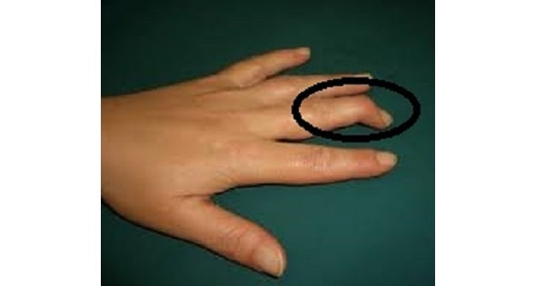 Image Based Question