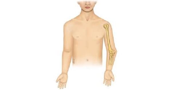 Image Based Question