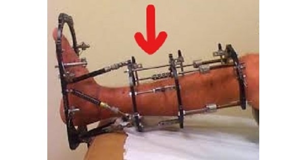 Image Based Question