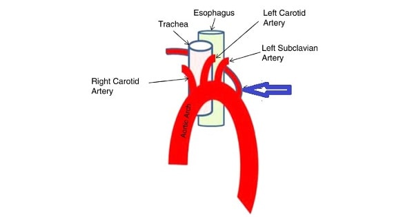 Image Based Question