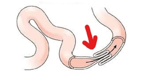 Image Based Question