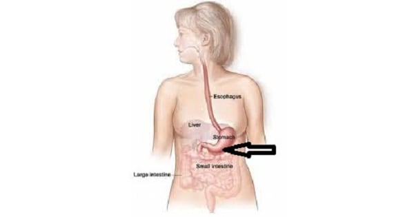 Image Based Question
