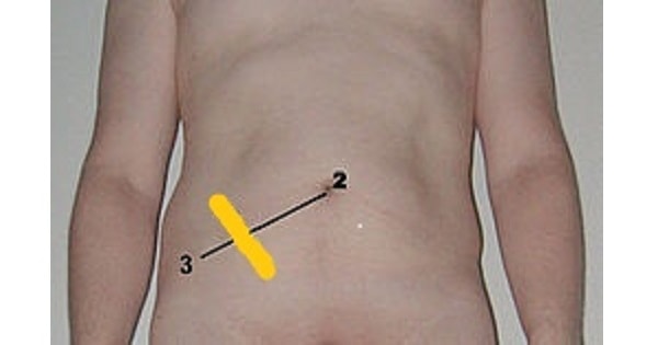 Image Based Question