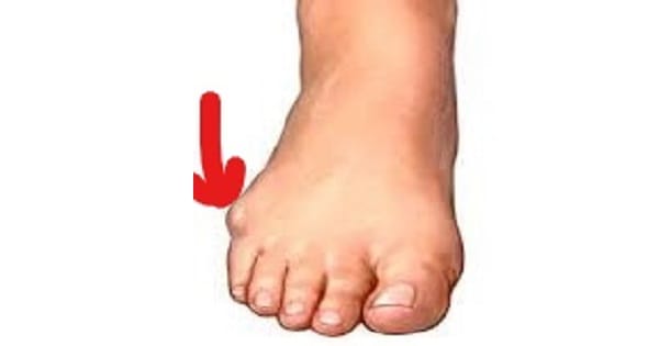 Image Based Question