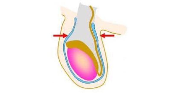 Image Based Question