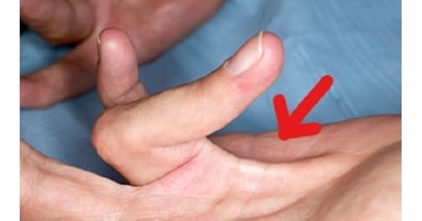 Image Based Question