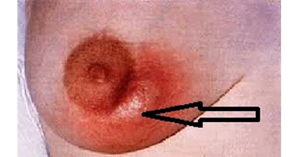 Image Based Question