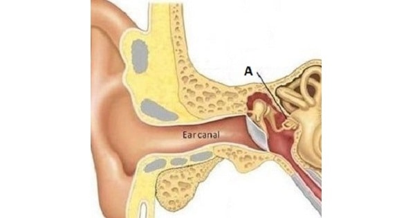 Image Based Question