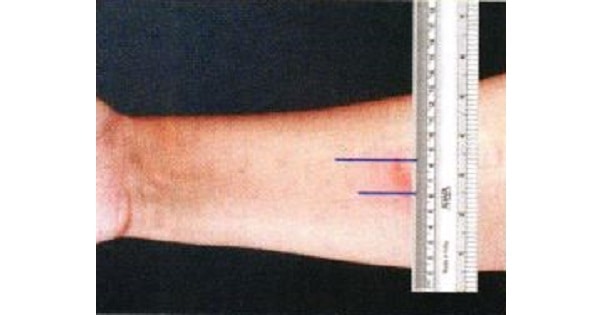 Image Based Question