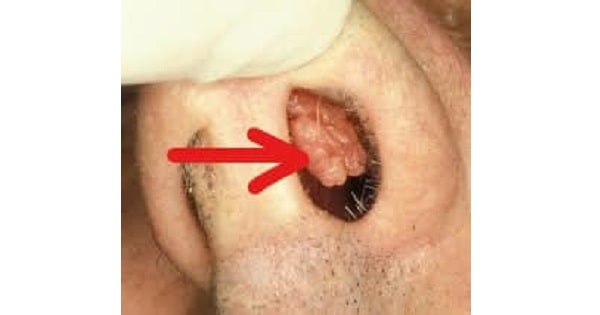 Image Based Question