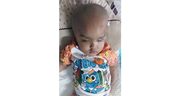 Image Based Question