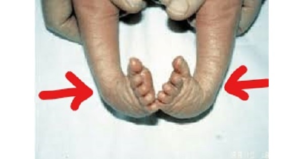 Image Based Question